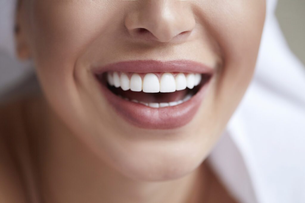 Porcelain Veneers in Arlington, TX