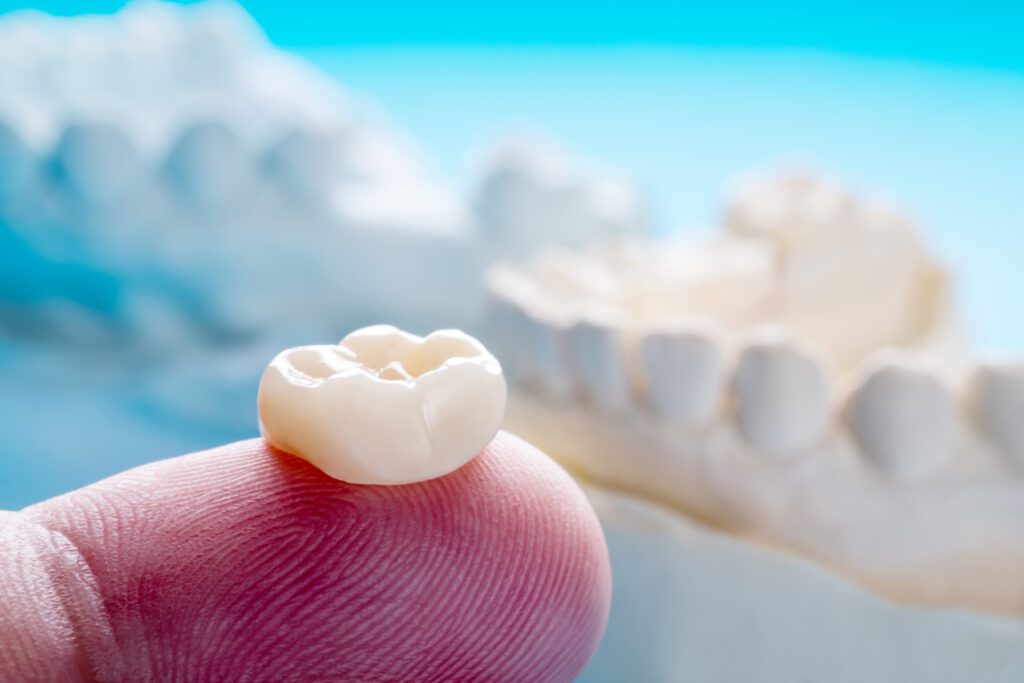 Dental crown in Arlington TX